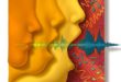Laser Voice Surgery